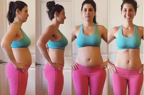 Conozca cómo desinflamar el vientre después del parto