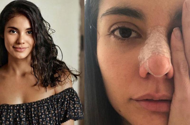 Elieen Moreno actriz colombiana contó como su novio la golpeaba 