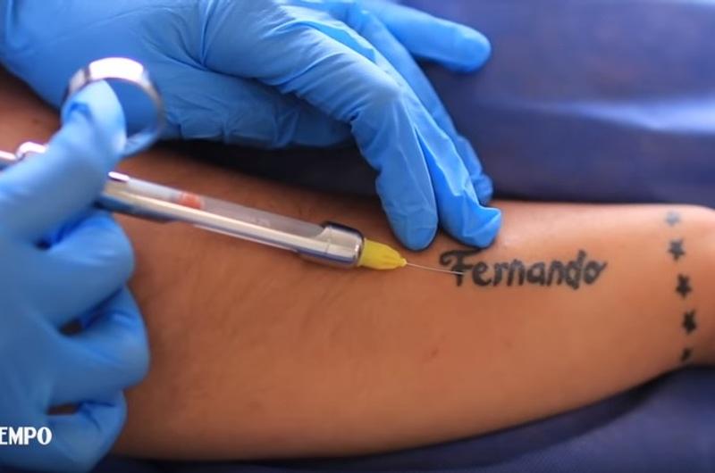 ¿Quiere borrarse un tatuaje?  Conozca el procedimiento