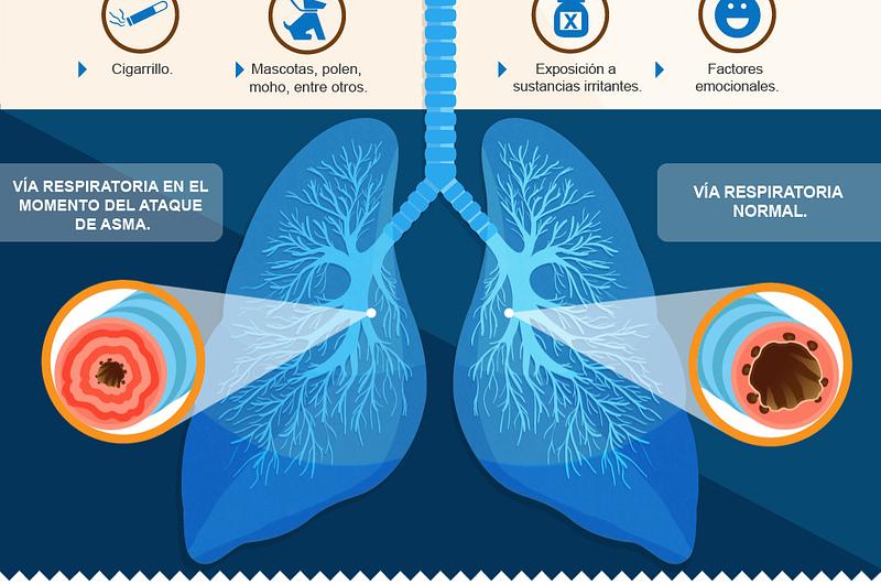 Lanzan nuevo portal www.respirayvive.com, una ayuda para los pacientes con Asma