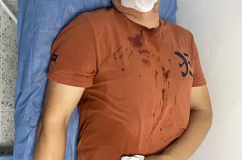 John Onofre sufre accidente en Restrepo: Esto sabemos