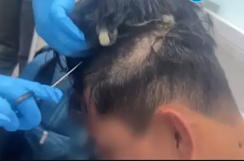 "Narco peluca": la insólita forma de traficar droga