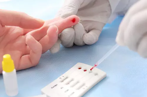 MinSalud desmiente alarmas falsas del VIH