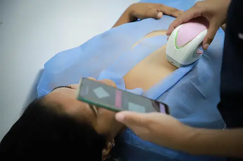 Cajacopi EPS consolida modelo efectivo contra el cáncer de mama