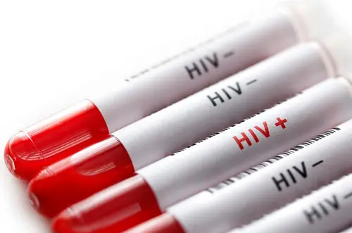 No aumenta el número de nuevas infecciones por VIH en Colombia