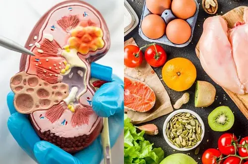 Estos son los primeros síntomas de insuficiencia renal