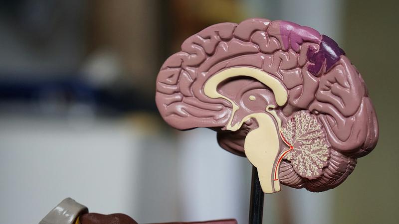 Ni dolor ni cirugías: el secreto para entender el Alzheimer